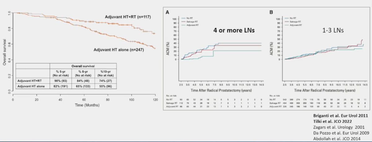 Retrospective studies suggest a benefit to adding radiotherapy to ADT in pN+ patients