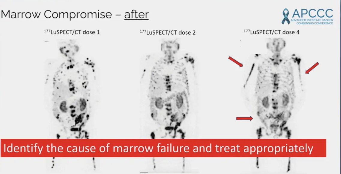 marrow compromise