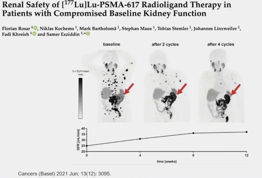 renal safety of Lu-PSMA
