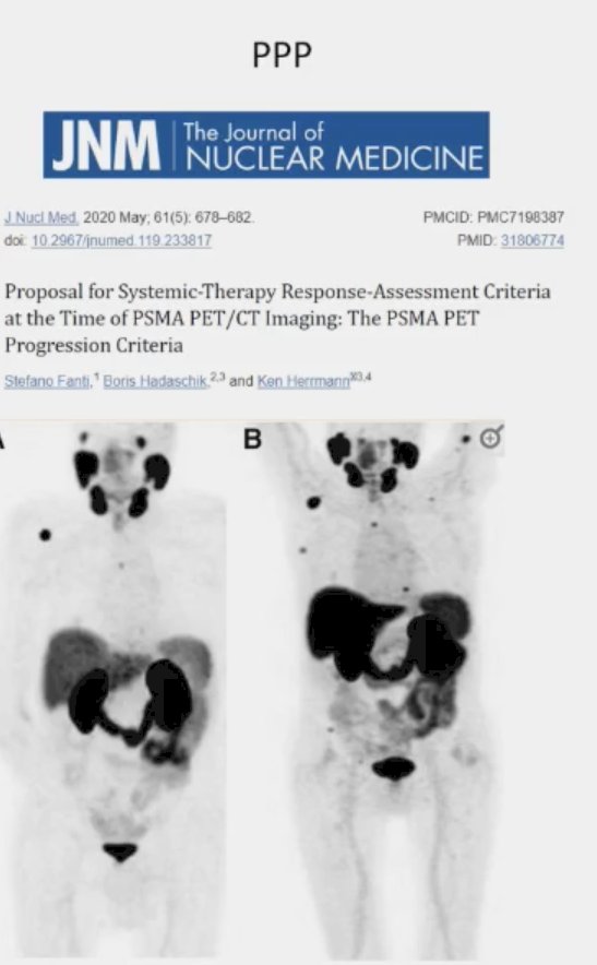 PSMA PET Progression (PPP) criteria