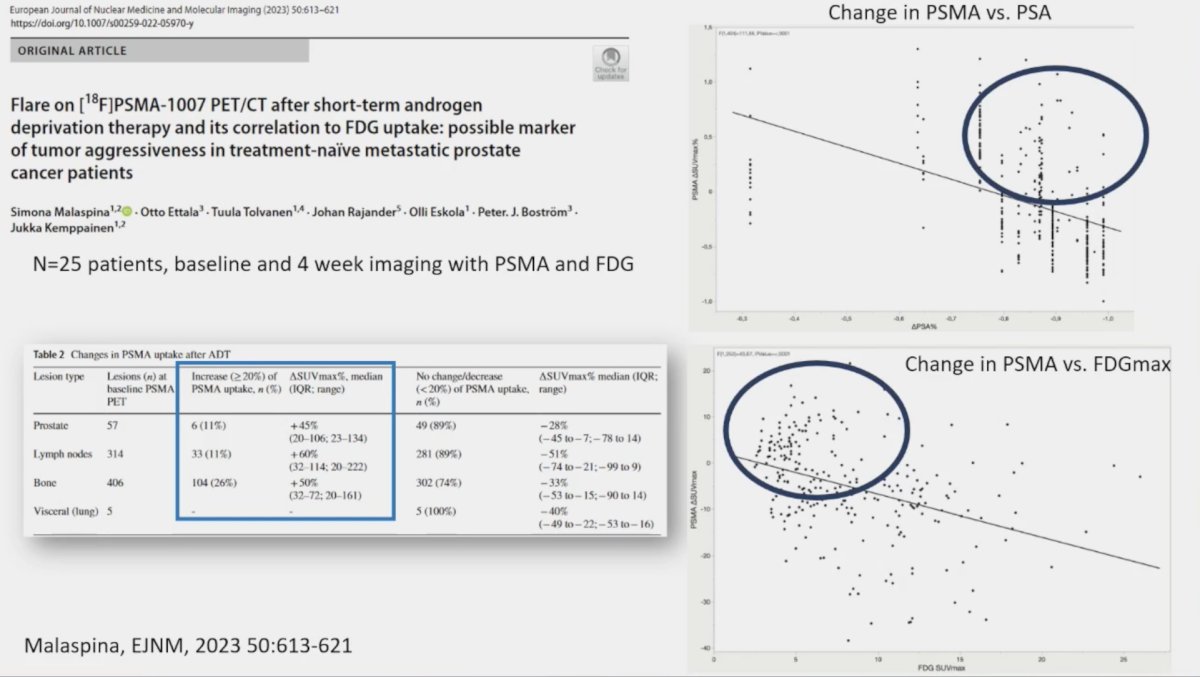 flare phenomenon on PSMA-PET/CT observed in mHSPC