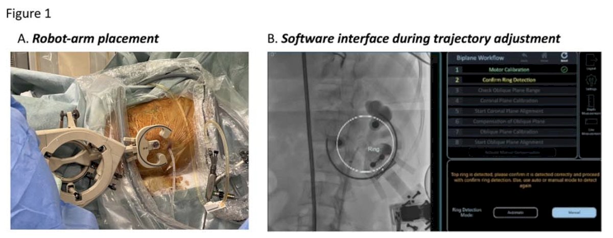 Clinical engineers leveraged the ANT-X targeting system to plan trajectories for renal system puncture, aiming for precise tract establishment