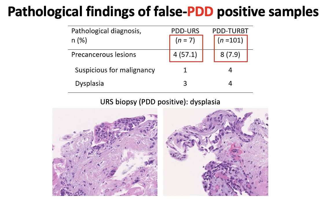 pathologic findings of PDD false-positive lesions