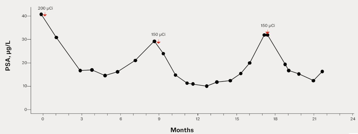 PSA responses with extended interval retreatment