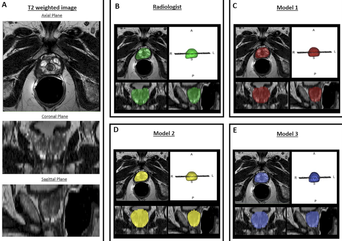 Shape-based factors influenced DL models (p < 0.001), while signal factors influenced all (p < 0.001)