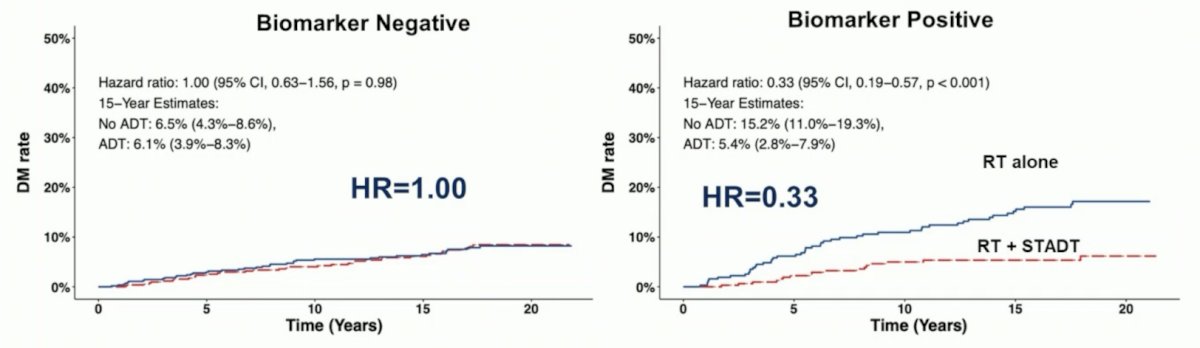  digital pathology-derived AI biomarker, the ArteraAI Prostate Test, may be used to predict short-term ADT benefits for intermediate risk patients