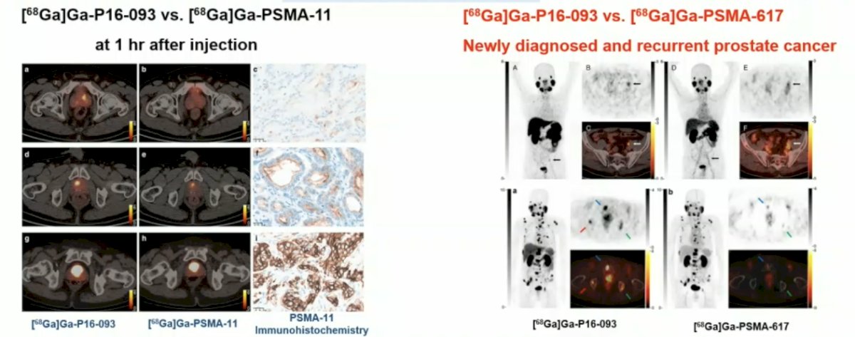 68Ga-P16-093 has the following compared to 68Ga-PSMA