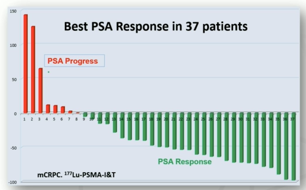 Dr. Hofman notes that the first results of 177Lu-PSMA-I&T were presented at the 3rd World Congress in Theranostics in March 2015, with data on 37 patients showing best PSA response