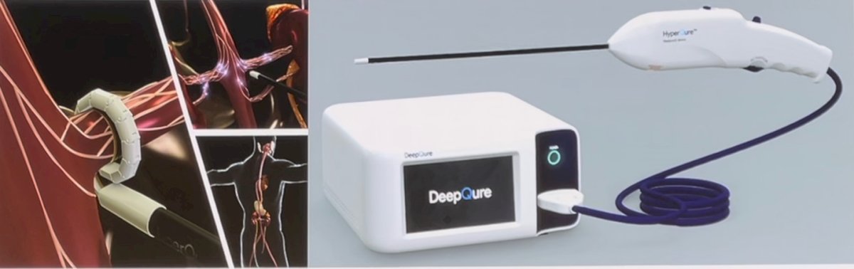 The team’s collaboration with HyperQure™ led to the creation of a specialized device for this procedure.