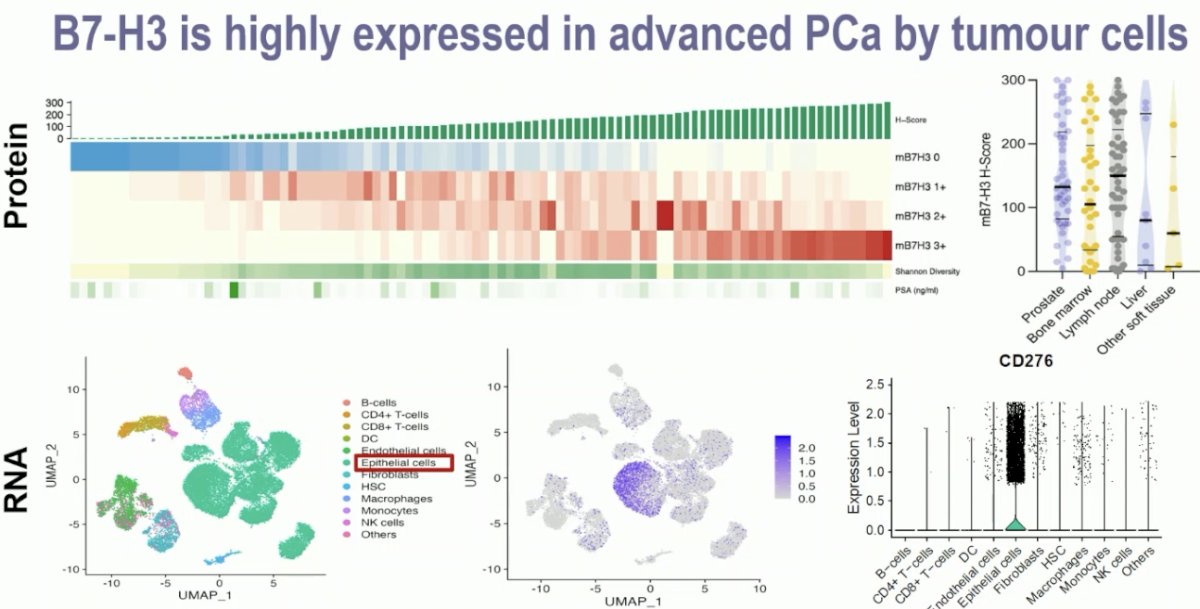 B7-H3 expression was markedly increased in tumor epithelial cells, with some concurrent expression in endothelial and immune cells