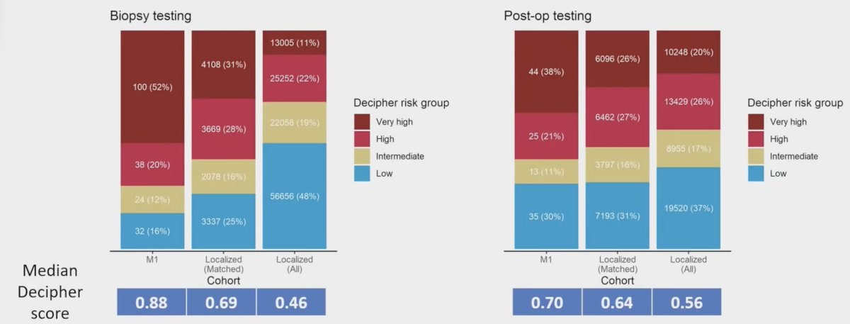  In the post-op cohort, the median Decipher score for metastatic patients was 0.70 compared to 0.64 and 0.56 in the matched and unmatched localized patient cohorts, respectively. Of note, in both cohorts, mCSPC patients were more likely to have very high risk scores compared to localized patients: