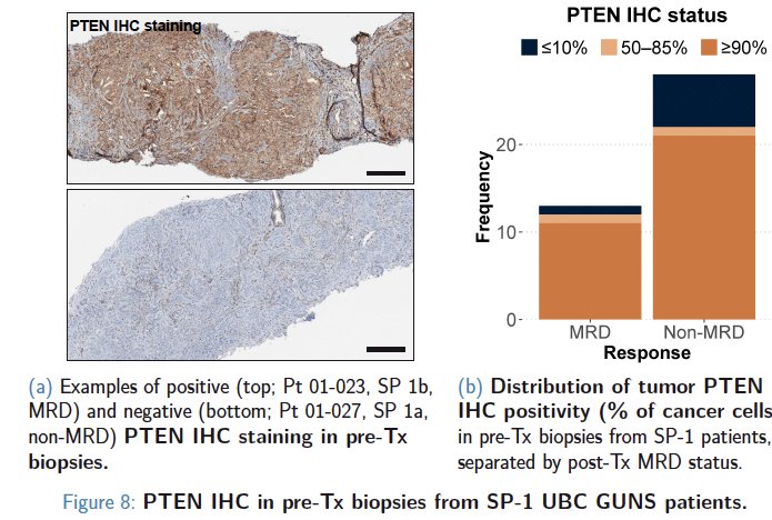 Pre-treatment biopsies from GUNS patients enrolled at UBC underwent PTEN immunohistochemistry (IHC). Despite exclusion of genomic PTENalt from sub-protocol 1 (assigned to sub-protocol 2), 7/41(17%) sub-protocol 1 UBC patients had PTEN-IHC-negative tumor biopsies. Negative (≤ 10% cancer cells) PTEN staining by IHC was more common in pre-treatment tumors from non-MRD (6/28; 21%) than MRD (1/13; 8%) patients (p=0.45).