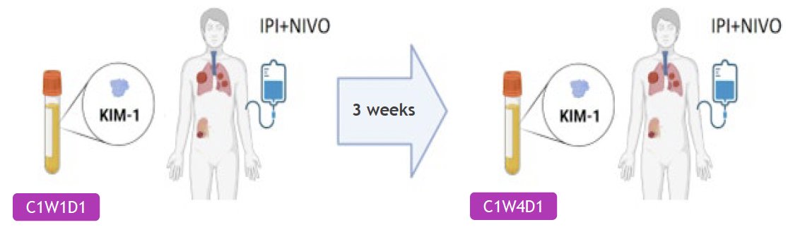 Serum KIM-1 was measured at baseline and 3 weeks after the first dose of nivolumab + ipilimumab (before second dose) using an established enzyme based electrochemiluminescence assay. The investigators were blinded to the identity of clinical samples during laboratory analysis. The association between KIM-1 levels at baseline and clinical outcomes was evaluated using Kaplan-Meier and Cox proportional hazards analyses. Changes in KIM-1 levels was assessed using linear mixed effects models and paired t-tests.