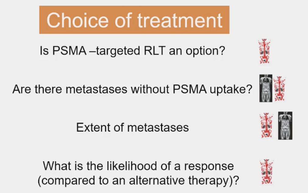 For selecting the choice of treatment: (i) is PSMA-targeted radioligand therapy an option? PSMA PET is clearly better, (ii) are there metastases without PSMA uptake? both whole body MRI and PSMA PET are adequate, with whole body MRI slightly better, (iii) extent of metastases - both whole body MRI and PSMA PET are adequate, with PSMA PET slightly better, (iv) what is the likelihood of a response (compared to an alternative therapy)? PSMA PET is clearly better