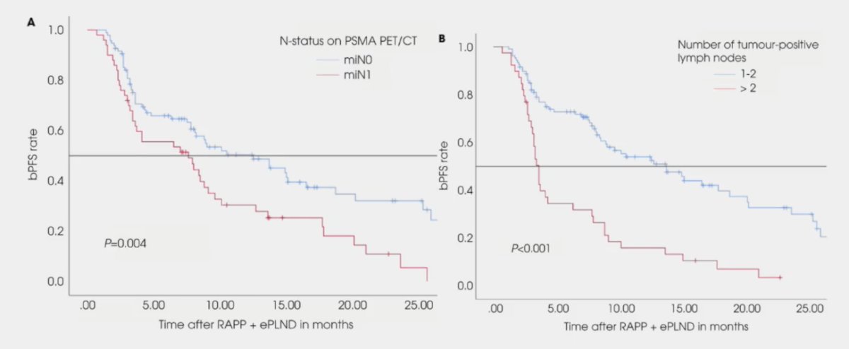 image-4.jpgPSMA PET has predictive value in pN1 disease. The following highlights the prognostic value of lymph node staging with PSMA PET/CT and extended pelvic lymph node dissection in patients with prostate cancer having N1 disease