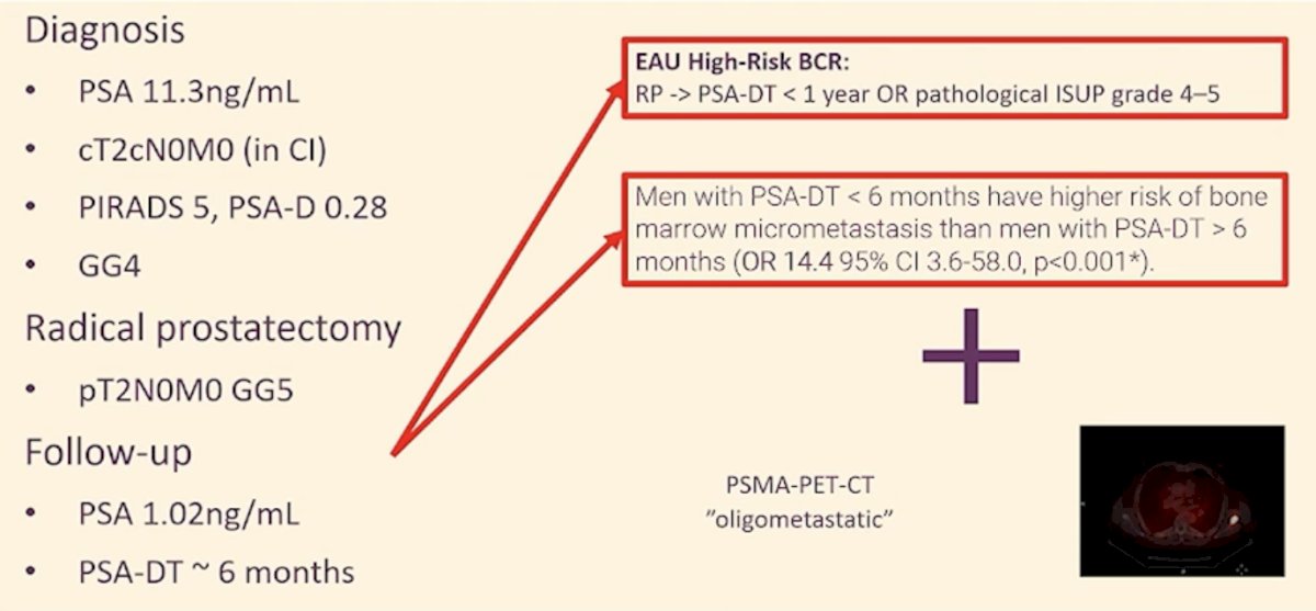 The patient presented at the beginning of this session had EAU high-risk biochemical recurrence (PSA doubling time <1 year and grade group 5 disease). Despite negative conventional imaging, he likely has microscopic oligometastatic disease. However, PSMA PET/CT identified a single lesion, placing him in a transitional stage between micrometastatic and oligometastatic disease.