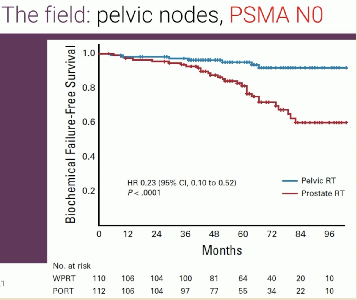 Over a median follow-up of 68 months, the 5-year biochemical failure-free survival was superior in the whole pelvis arm (95% versus 81.2%; HR: 0.23; p<0.001), as well as 5-year disease-free (89.5% versus 77.2%; HR: 0.40, p=0.002) and distant metastasis-free survivals (95.9% versus 89.2%; HR: 0.35, p=0.01). There were no significant differences in 5-year overall survival rates (92.5% versus 90.8%, HR: 0.92, p=0.93).5 As such, Dr. Ost argued that whole pelvis radiotherapy is indicated for higher risk patients, even in the setting of PSMA PET node negative disease.