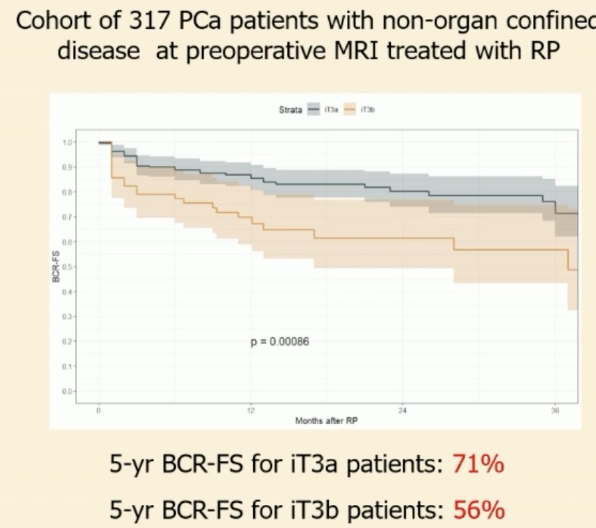 Why does local staging matter in this setting? Patients with evidence of seminal vesicle involvement on imaging (iT3b) have significantly worse prognoses compared to patients with evidence of cT3a disease on imaging (iT3a). The 5-year biochemical recurrence-free survival for iT3b patients is 56%, compared to 71% for iT3a patients (HR: 1.8, p=0.04)