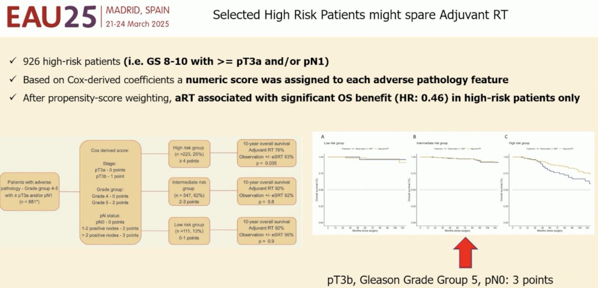 Another advantage of radical prostatectomy for this patient is that it provides accurate pathologic grading and staging information that may help guide a risk-adapted approach to adjuvant radiotherapy utilization, with adjuvant radiotherapy reserved for the high-risk patients