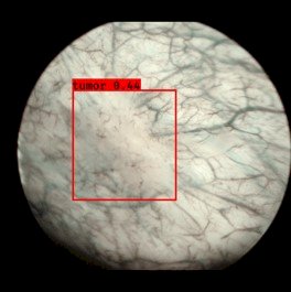 The dataset included a total of 2,625 images, comprising 2,371 non-tumor images and 254 flat tumor images. The YOLO model was trained on 1,896 images and tested on the remaining 729 images. The model achieved a sensitivity of 90% and specificity of 90.6%. The area under the receiver operating characteristic curve (AUC) for detecting flat tumors was calculated at 93.4% with a likelihood score of 0.163, indicating robust performance for distinguishing flat tumors from non-tumor images.