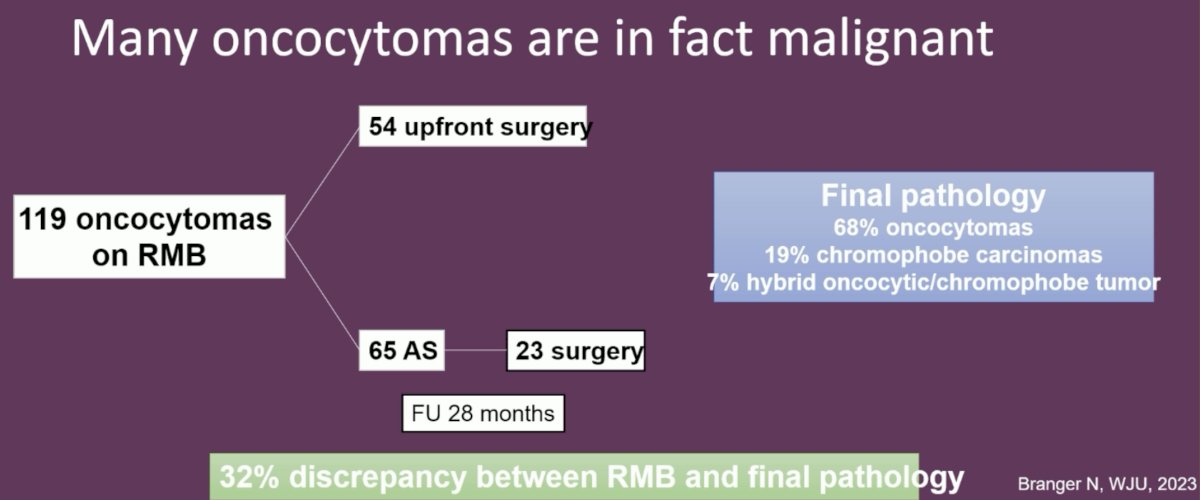 The other issue is that despite a benign finding on RMB, there is still a likelihood of underlying malignancy. In 2023, Branger et al. demonstrated in a series of 119 patients with findings of an ‘oncocytoma’ on RMB that only 68% of these patients are actually found to have an oncocytoma on the surgical specimen. 19% of these patients with an oncocytoma on RMB have underlying chromophobe carcinomas, and 7% have hybrid oncocytic/chromophobe tumors.