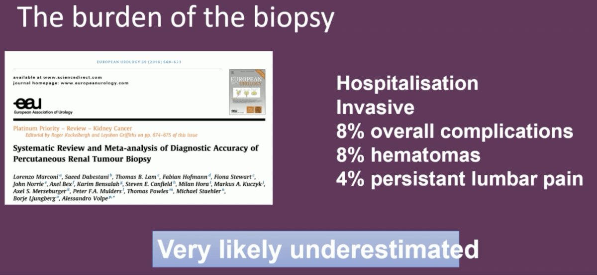 Furthermore, RMBs are not ‘free of cost’. They are associated with increased rates of hospitalization, are invasive in nature, and are associated with complications in 8% of cases, overall, including hematomas and persistent lumbar pain in 8% and 4% of cases, respectively.