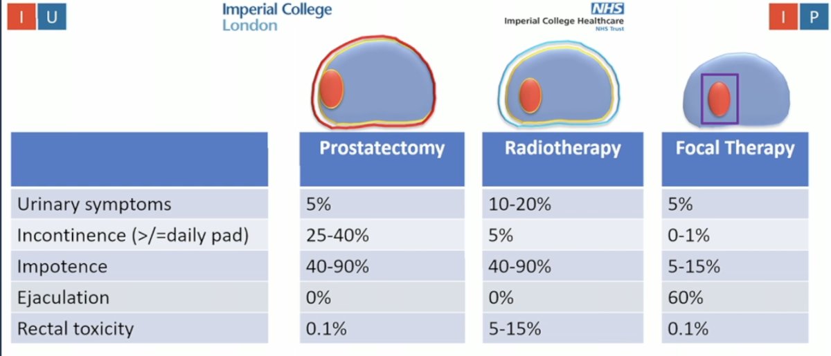  Dr. Ahmed discussed how we invest significant energy, time, effort, and resources into identifying the index lesion, only to often discard that precision by treating the entire prostate. He emphasized that functional outcomes are overwhelmingly better with focal therapy, noting a 5- to 10-fold improvement in urinary symptoms and rates of impotence, as illustrated below.