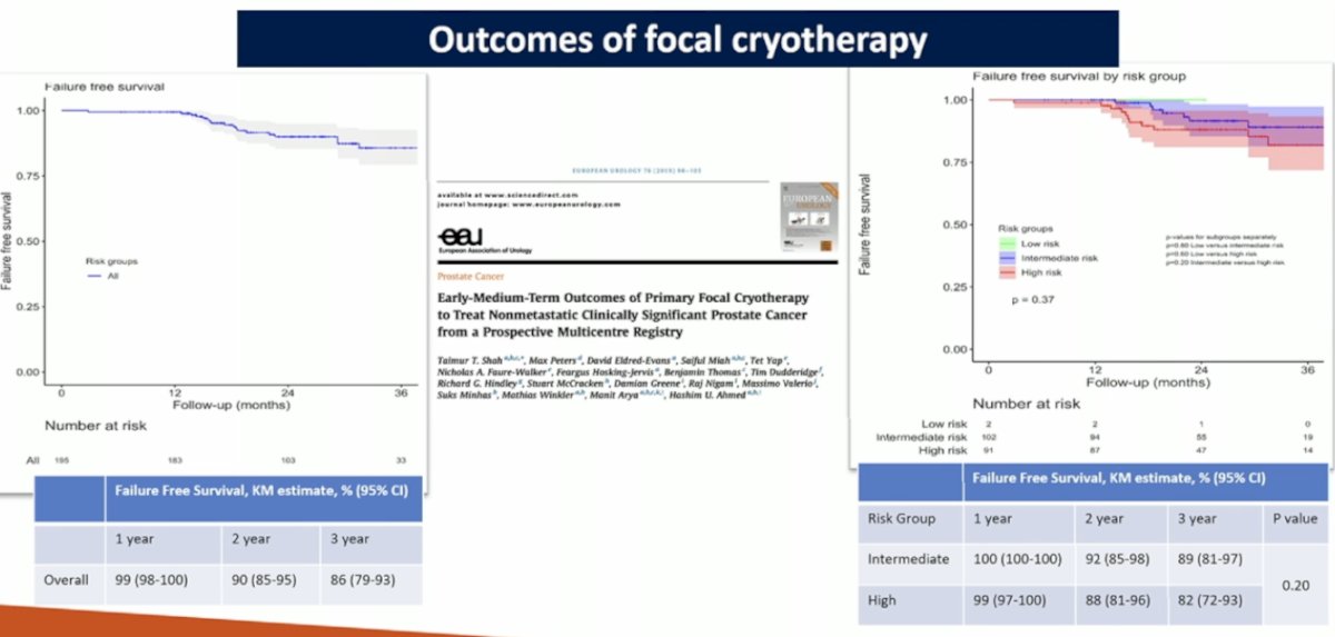 Cryotherapy and IRE have demonstrated excellent outcomes, with overall failure-free survival (FFS) rates of 90% at 2 years and 86% at 3 years.