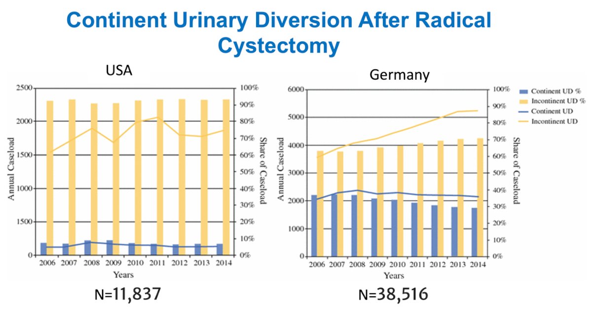 Moreover, Dr. Bochner discussed that despite advancements in bladder cancer surgery, the rate of continent urinary diversion in the United States remained stable from 2006 to 2014, with 11,837 patients receiving continent diversions during that period. In contrast, 38,516 patients underwent continent diversion in Germany, where it has historically played a major role in bladder cancer surgery, although its use has declined over the past decade.