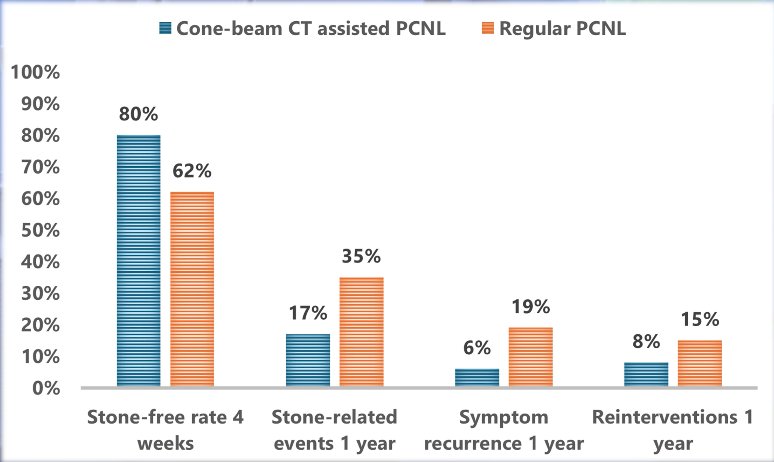 Long-term follow-up data were available for 133 patients. At one year, the CBCT group had significantly fewer stone-related events (17% vs 35%, p = 0.02) and symptom recurrences (6% vs 19%, p = 0.02) compared to the control group. Although reintervention rates were lower in the CBCT group (8% vs 15%), this difference did not reach statistical significance (p = 0.2) (Figure 3).