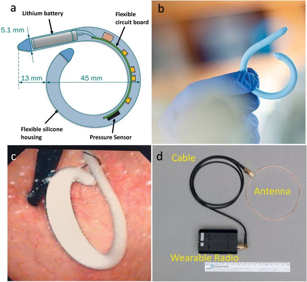 Figure 1 (below). A) A diagram of the UM and its components are detailed. B) An actual image of the UM and its relative size to a hand is shown. C) The UM is shown to be deployed in the bladder via cystoscopy visualization. D) A UM antenna and radio receiver used to collect transmitted data is depicted.