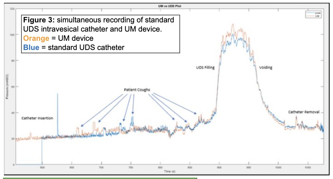 Figure 3 below illustrates the simultaneous recordings of the multichannel UDS and UM device.