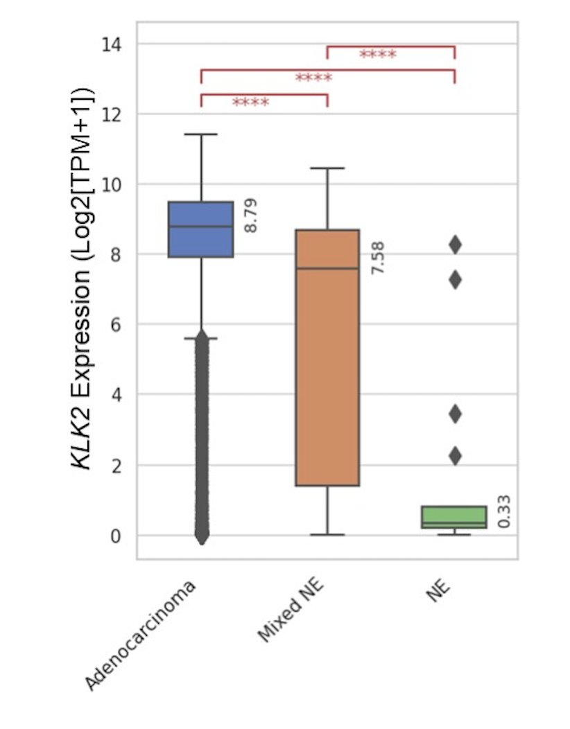 KLK2 was enriched in adenocarcinoma versus mixed versus neuroendocrine prostate cancer (8.79 versus 7.58 versus 0.33 log2[TPM+1], p < 0.001):