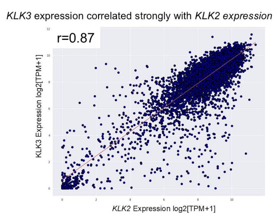 In primary tumors, high KLK2 associated positively with&nbsp;SPOP&nbsp;and negatively with&nbsp;PI3K/PTEN,&nbsp;TP53, and&nbsp;RB1&nbsp;alterations. Across primary, lymph node, and distant metastatic tumors, high KLK2 associated positively with androgen receptor signaling and negatively with neuroendocrine prostate cancer signaling (all p < 0.001). KLK2 strongly correlated with KLK3 (PSA) expression (R = 0.87):