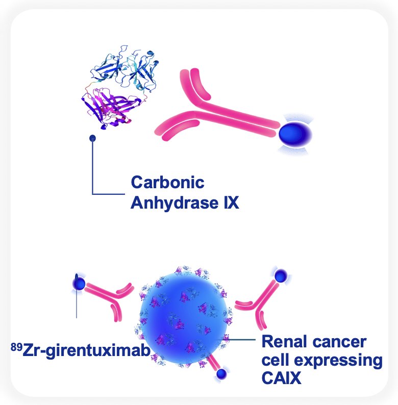 89Zr-labeled girentuximab is an investigational agent targeting CAIX for PET imaging, with hepatobiliary excretion that allows optimal renal visualization. Girentuximab is an IgG1 kappa light chain&nbsp;chimeric monoclonal&nbsp;antibody that binds with high specificity&nbsp;to CAIX and is internalized. The payload, 89Zr, has a half-life of 3.3 days that is well suited for&nbsp;antibody-based imaging, emits a lower-energy positron&nbsp;for&nbsp;improved image resolution, and reduces radiation to the thyroid compared to iodine nuclides: