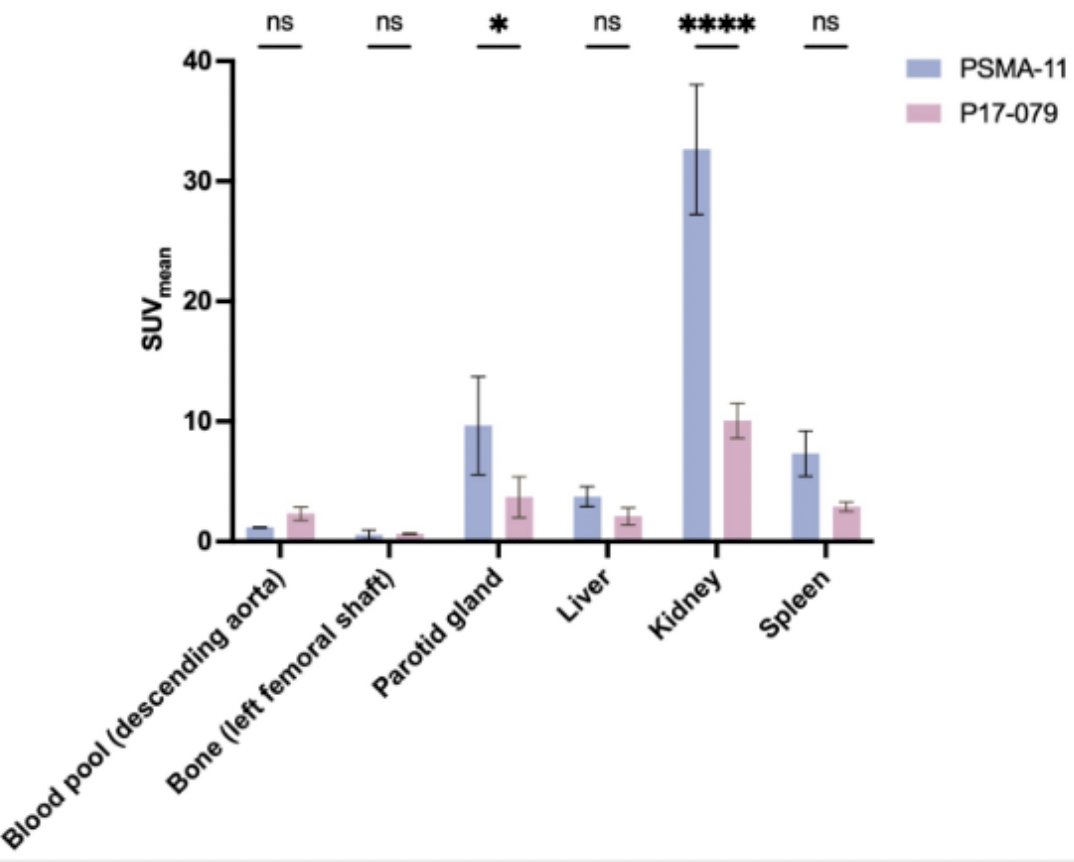 In the three patients, no side effects were observed during the 3-month follow-up. A comparison of organ uptake at 60 minutes revealed that 68Ga-P17-079 PET/CT exhibited significantly lower uptake in the salivary glands (SUVmean&nbsp;3.69 ± 1.39 versus 9.65 ± 3.34, P = 0.0152) and kidneys (SUVmean&nbsp;10.07 ± 1.18 versus 32.65 ± 4.42, p < 0.0001) compared to 68Ga-PSMA-11 PET/CT: