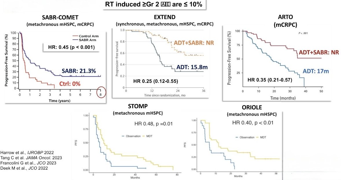 Reviewing the SABR-COMET, EXTEND, ARTO, STOMP, and ORIOLE trials, Dr. Salgado highlighted consistent improvements in progression-free survival with metastasis-directed radiotherapy across both hormone-sensitive and castration-resistant settings, with median PFS gains most pronounced when SBRT and ADT. Importantly, grade ≥2 adverse events were ≤10% across studies, underscoring the favorable safety profile of MDT. However, Dr. Salgado emphasized the glaring gap, OS data are largely absent or immature, leaving unanswered whether these PFS gains ultimately translate into longer life.2-5
