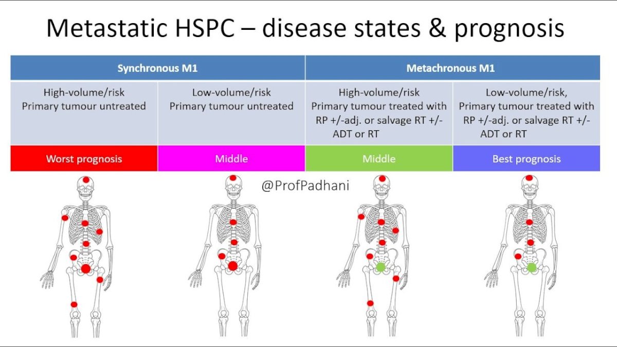 Dr. Chavarriaga then discussed biomarkers in the mHSPC setting, for which there is heterogeneity in outcomes depending on disease presentation and volume/risk of disease:&nbsp;