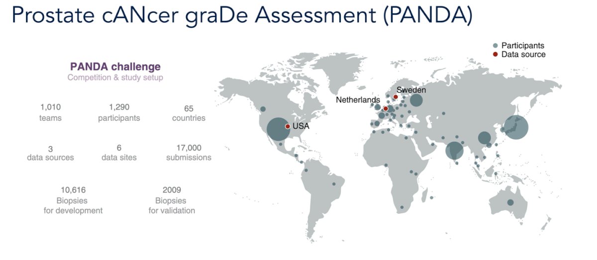 This initiative demonstrated the potential of AI to match or surpass pathologists in Gleason grading while reducing interobserver variability and promoting greater consistency in prostate cancer diagnosis worldwide (6) Dr Cooperberg highlighted this algorithm is opened source and can be easily downloaded and access anywhere in the world.&nbsp;