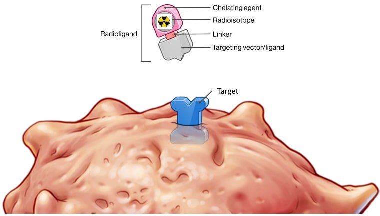 Theranostics represents a rapidly evolving field in prostate cancer that integrates both diagnosis and therapy using the same molecular target. A radioligand is designed with a targeting vector, typically directed against PSMA, which is linked to a radioactive isotope. When labeled with a diagnostic isotope such as 68Ga or 18F, it allows for precise localization of disease through PET imaging. The same ligand can then be coupled with a therapeutic isotope such as 177Lu or 225Ac, delivering targeted radiation directly to tumor cells while sparing surrounding normal tissues. This dual ability to both “see” and “treat” disease exemplifies personalized medicine and has reshaped the management paradigm in advanced prostate cancer.