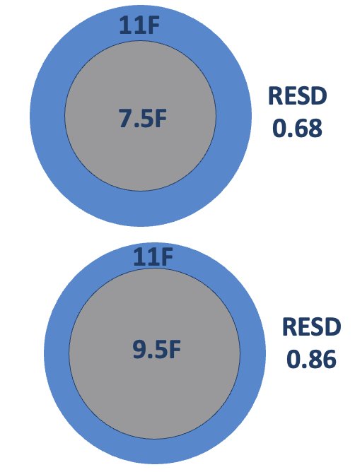 On the other end of the spectrum, the miniaturized 6.3 Fr ureteroscope consistently achieves RESD values ≤0.66 across all sheath sizes, supporting significantly lower intrarenal pressures (Figure 3).