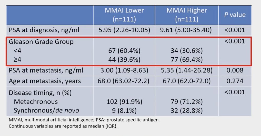 Dr. Sutera presented data evaluating MMAI in the oligometastatic CSPC setting, drawing on patients from the STOMP and ORIOLE trials. Among 222 men with ≤5 metastases, those with higher MMAI scores had significantly higher PSA levels at diagnosis and at the time of metastasis, were more likely to have Gleason Grade Group ≥4, and more often presented with synchronous or de novo disease compared to those with lower MMAI scores. These findings suggest that MMAI can discriminate biological risk in oligometastatic disease, potentially identifying patients with more aggressive disease biology.2