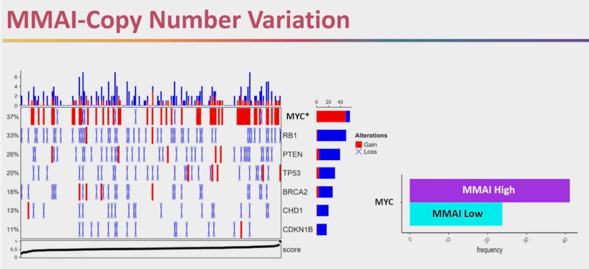 Dr. Sutera presented exploratory data linking MMAI scores with underlying genomic alterations in a cohort of 227 patients who underwent somatic DNA panel sequencing. Specifically, higher MMAI scores were significantly associated with MYC copy number gain, observed in 42% of patients, while other alterations such as RB1, PTEN, TP53, BRCA2, CHD1, and CDKN1B did not show a meaningful difference, as illustrated below. This finding suggests that MYC amplification may contribute to the aggressive biology captured by higher MMAI scores, reinforcing its potential role as a prognostic and biologically relevant biomarker&nbsp;