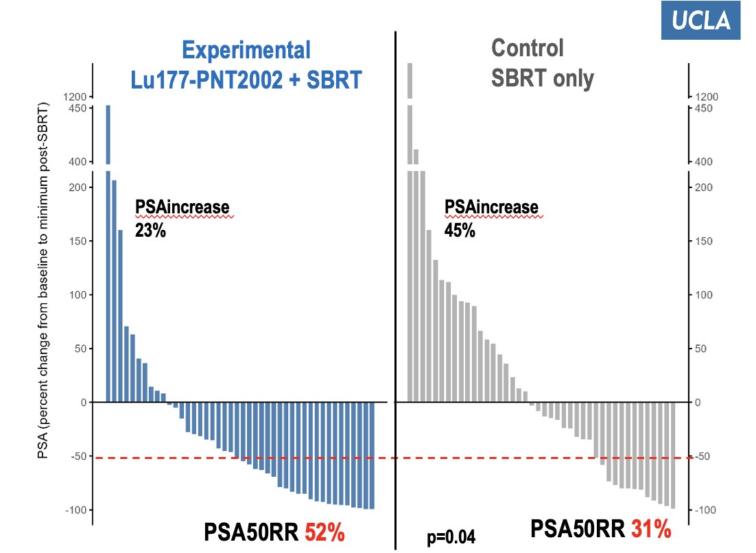 Dr. Calais highlighted that the PSA50 response rate (≥50% PSA decline from baseline) was notably higher in the experimental arm receiving 177Lu-PNT2002 plus SBRT, at 52%, compared to 31% in the SBRT-only control arm (p=0.04). Additionally, PSA increases were observed in 23% of patients treated with 177Lu-PNT2002 versus 45% in the control group, suggesting enhanced biochemical response with the addition of radioligand therapy.&nbsp;