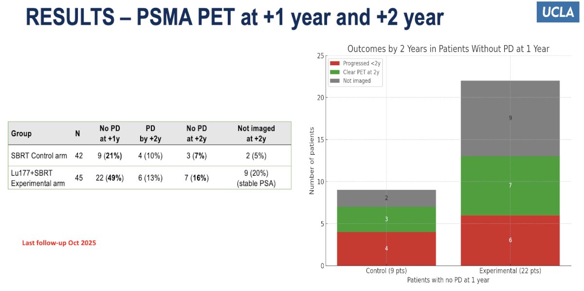 Moreover, PSMA PET assessments at one and two years demonstrated sustained disease control favoring the 177Lu-PNT2002 + SBRT arm. At one year, 49% of patients in the experimental arm showed no progression compared to 21% in the SBRT-only group. By two years, 16% of patients in the combination arm remained progression-free versus 7% in the control arm, with an additional 20% of patients in the experimental group maintaining stable PSA levels but not yet re-imaged.