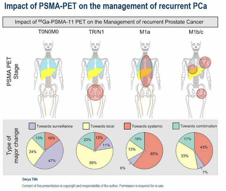 Why is this significant? Dr. Tilki noted that the utilization of PSMA PET in this patient population leads to management changes in more than half of patients with biochemical recurrence.2
