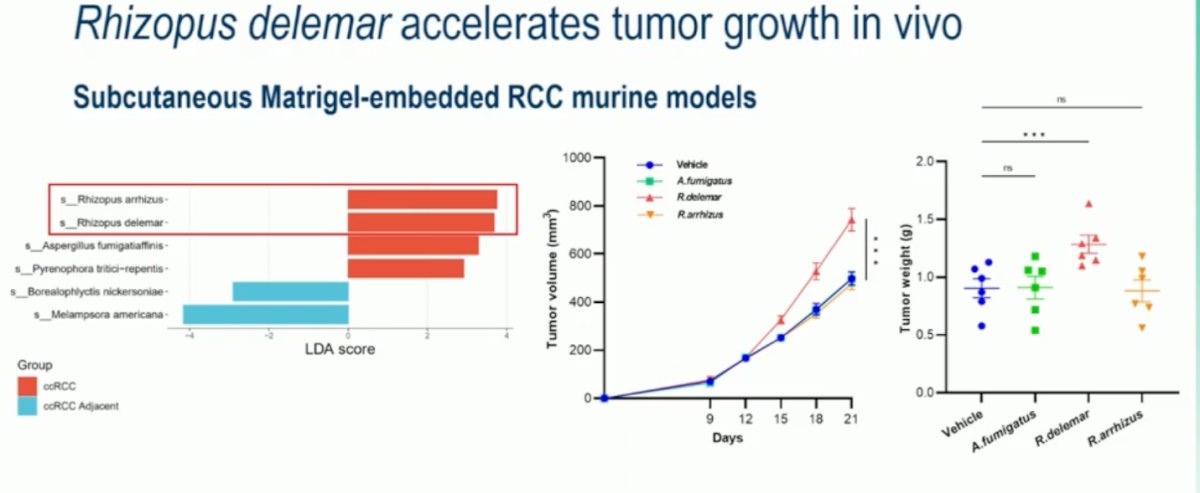The investigators identified Rhizopus delemar as the fungal species most strongly associated with tumor progression in ccRCC. Using subcutaneous Matrigel-embedded RCC murine models, they demonstrated that R. delemar significantly accelerated tumor growth and increased tumor weight compared with controls and other fungal species, such as A. fumigatus or R. arrhizus..&nbsp;
