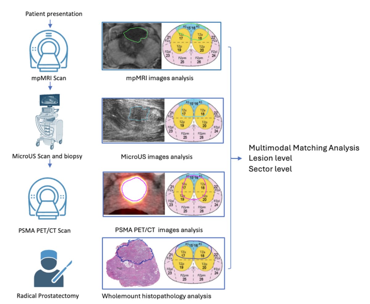 WSAUA 2025: Head-to-Head Comparison of Multimodal Imaging in the Detection of Prostate Cancer using Whole Mount Histopathology as a Reference image 1
