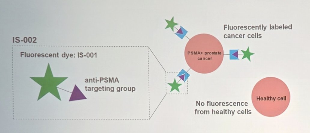 Dr. Carroll argues that for the surgical treatment of prostate cancer, better imaging may be (is?) critical. IS-002 consists of a PSMA-targeting group conjugated to a fluorescent dye detectable in the 785–804 nm near infrared spectrum. Because PSMA is overexpressed on prostate cancer cells and minimally expressed in surrounding healthy tissue, selective cancer imaging becomes feasible: