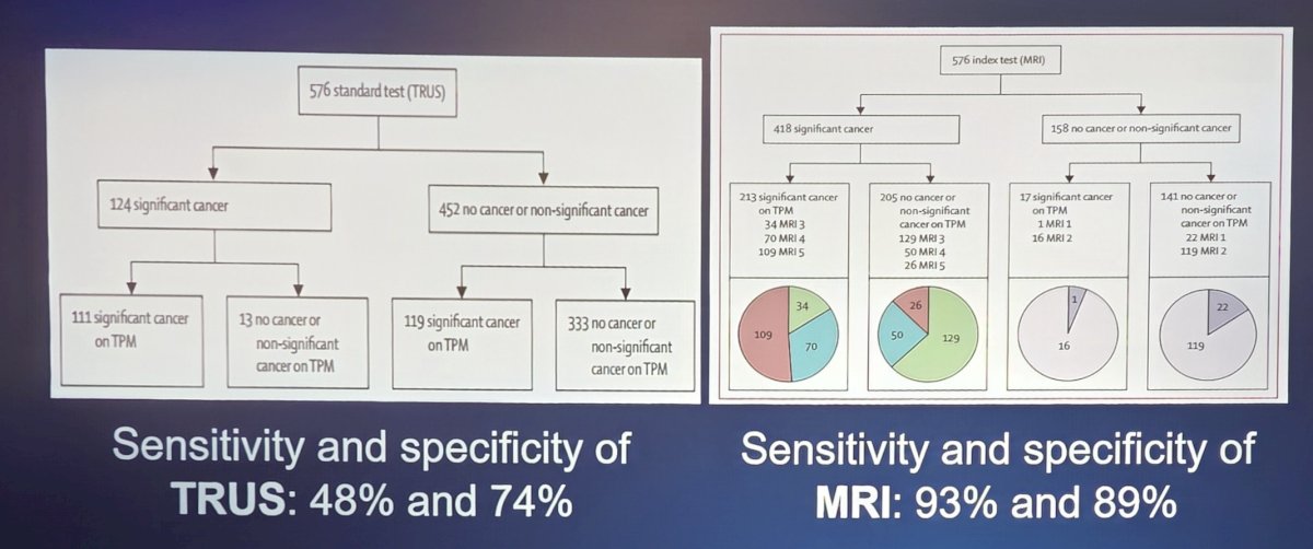 Dr. Pinto started by emphasizing that the 12 core systematic “blind” prostate biopsy has low sensitivity and specificity in detecting clinically significant cancer. This is secondary to potentially only sampling 0.04% of gland, difficulty sampling anterior and apical regions, and less effectiveness in patients with prior negative biopsy. When assessing ultrasound versus MRI, the sensitivity and specificity of TRUS is 48% and 74%, respectively, and for MRI in the PROMIS trial1 was 93% and 89%, respectively:&nbsp;